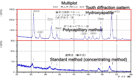 Fig. 6 Measurement of the Tooth