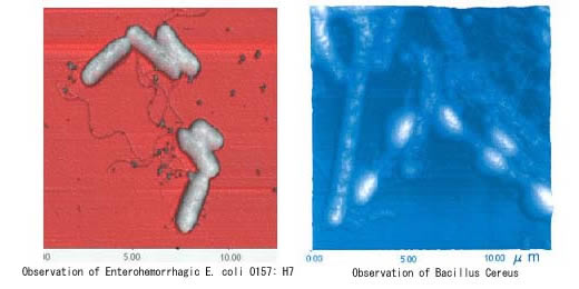 Microscope Observations of O157