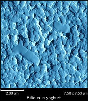 Example of the observation of bifidus in yoghurt