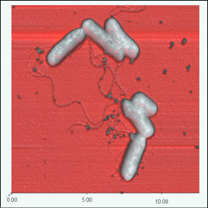 Observation of Enterohemorrhagic E. coli O157:H7