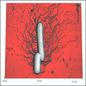 Observation of Proteus Bacteria