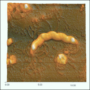 Observation of Helicobacter pylori