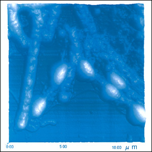 Observation of Bacillus cereus