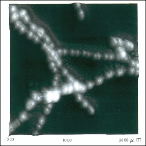 Observation of Streptococcus pyogenes